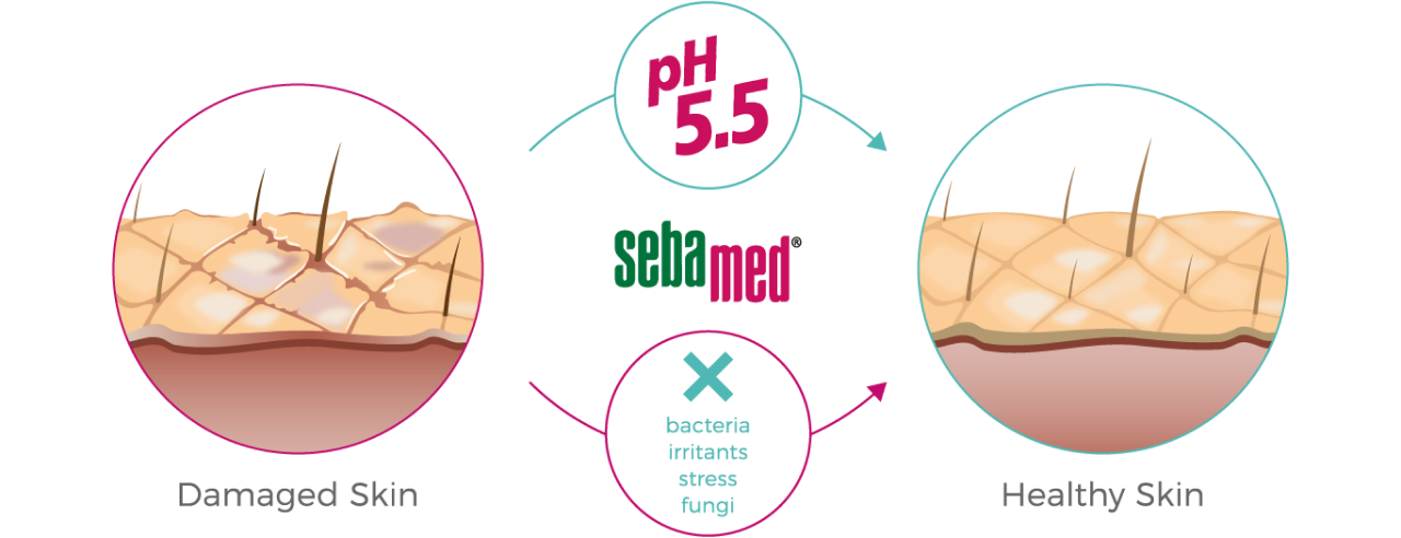 pH-5.5